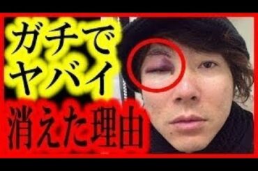 【裏側】川越シェフがテレビから消えた本当の理由…怪我？性格？腹黒？