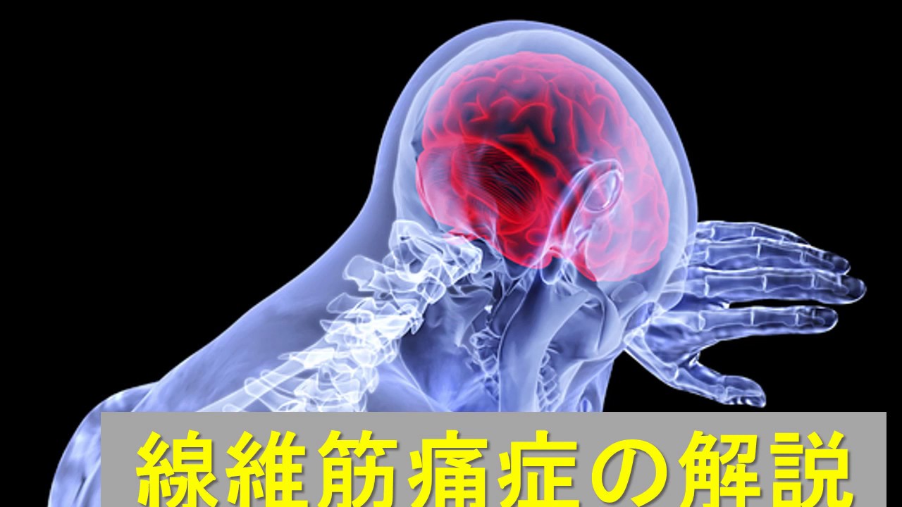 八木亜希子さんが発症した線維筋痛症について解説します