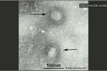 新型ウイルス 感染拡大想定の対処方針の策定急ぐ 政府