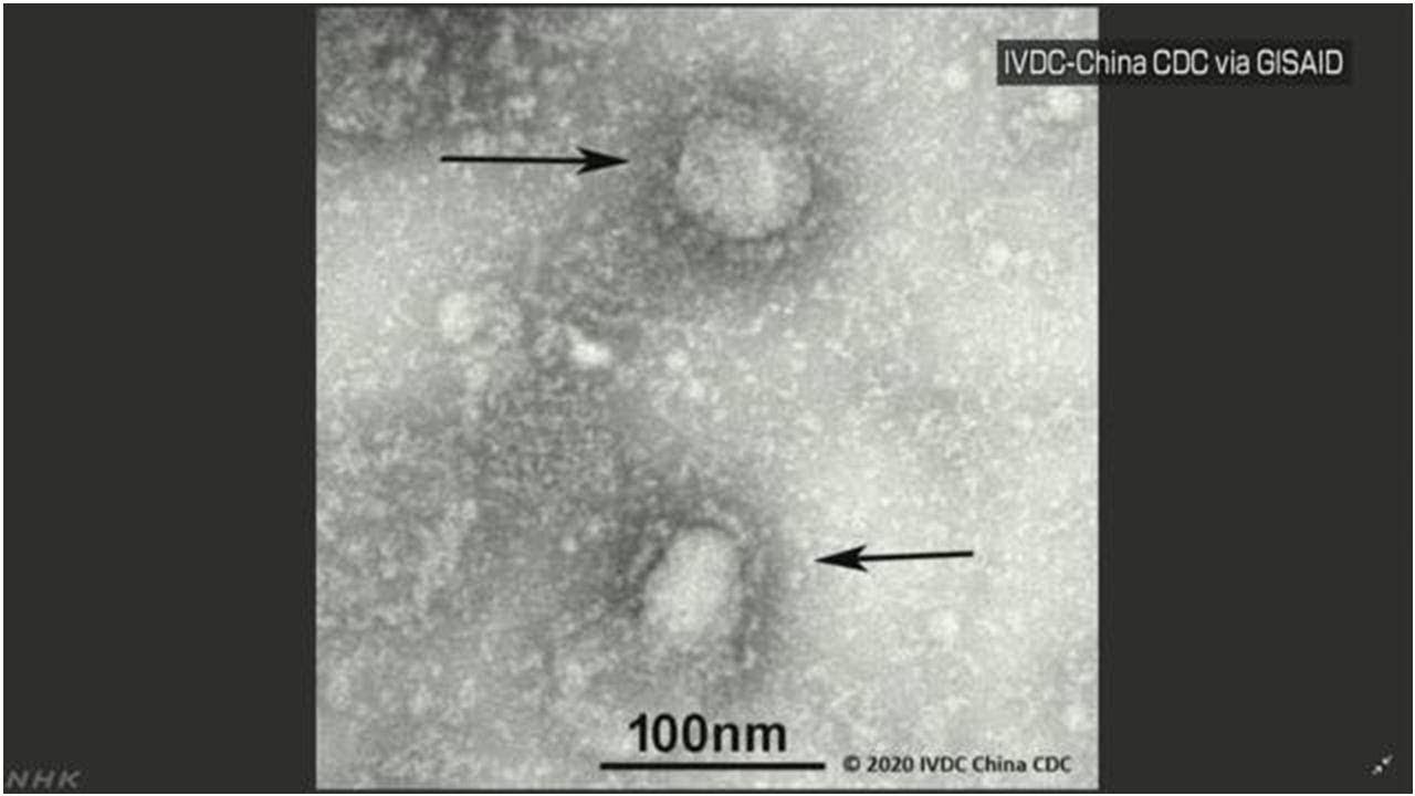 新型ウイルス 感染拡大想定の対処方針の策定急ぐ 政府 新型ウイルス 感染拡大想定の対処方針の策定急ぐ 政府