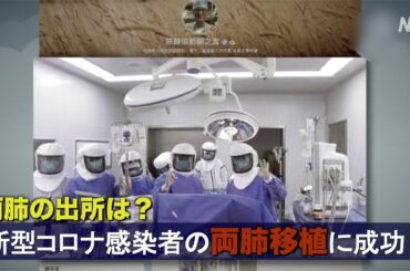 中国で新型コロナウイルス感染者の両肺移植に成功？ ネットユーザー「肺はどこから？」