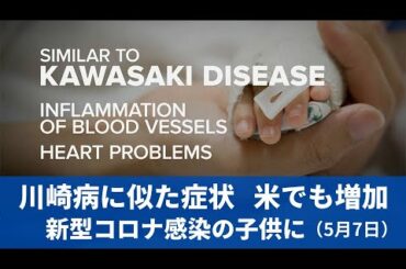 5月7日 米でも増加  新型コロナ感染の子供に川崎病に似た症状