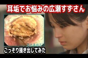 耳垢にお悩みの【広瀬すずさん】の巨大耳くそをごっそり掻き出し除去！スッキリ気持ちいい神回