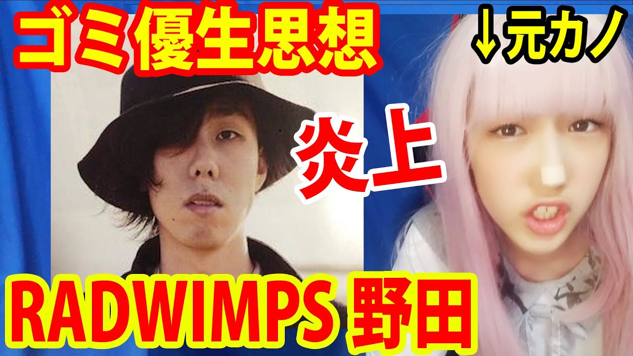 RADWIMPS野田洋次郎のTwitterが優生思想で乙武洋匡も激怒！美しくもがくゾこら！と彼女が言いたい
