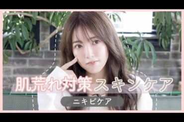 【ニキビケア】肌荒れ対策！ニキビで悩んでいる方へ