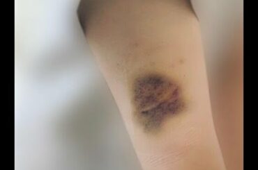 《事務所は契約解除決定》「共演NG」俳優・小澤廉を直撃　元JK恋人へのDV・堕胎強要・自殺未遂…｜ニフティニュース