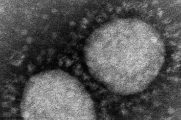 東京で「変異種」確認 市中感染の疑い