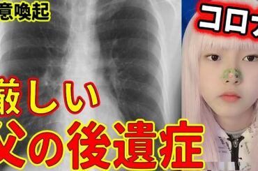 新型コロナウイルスの後遺症がしんどい！倦怠感・息切れ・動悸・うつ状態退院後の治療と対策！ビタミンＤと血栓予防！ pcr検査 変異種