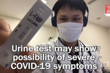 Urine test may show possibility of severe COVID-19 symptoms