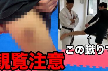 【悲報】朝倉未来選手に蹴ってもらった右足が悲惨なことに