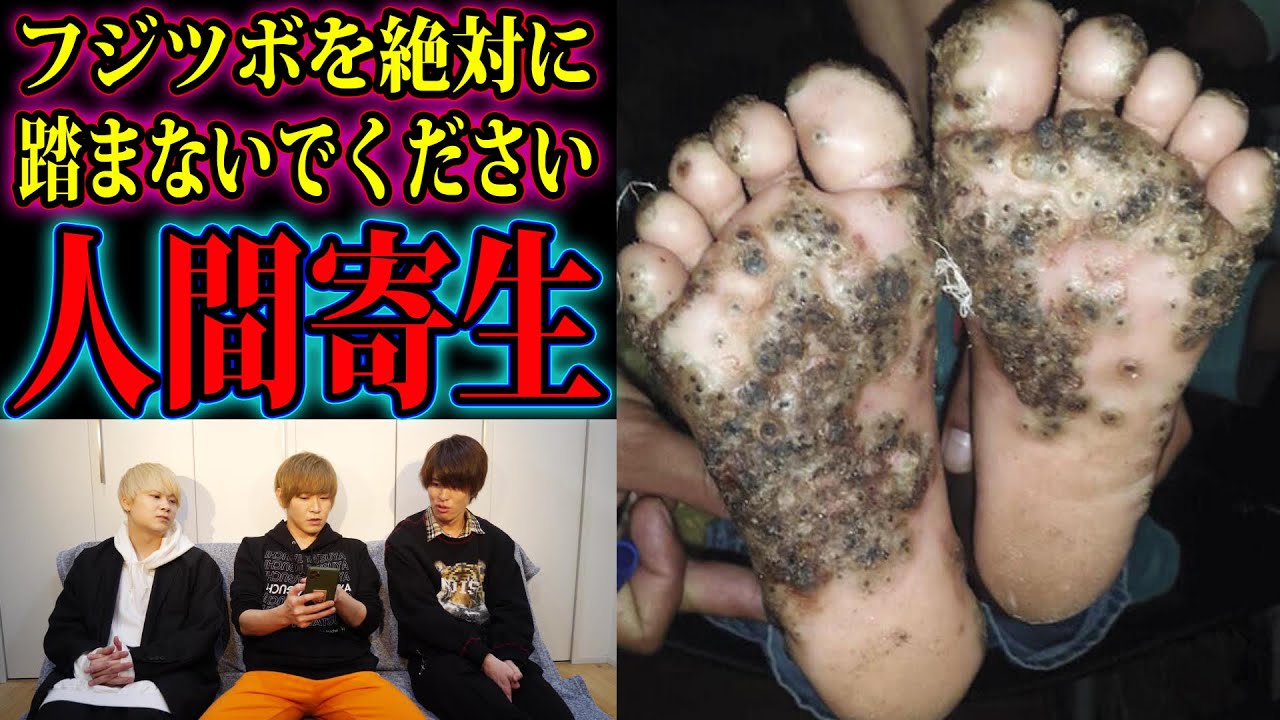 海でフジツボを踏むと人間に寄生してしまうというヤバい話。 海でフジツボを踏むと人間に寄生してしまうというヤバい話。