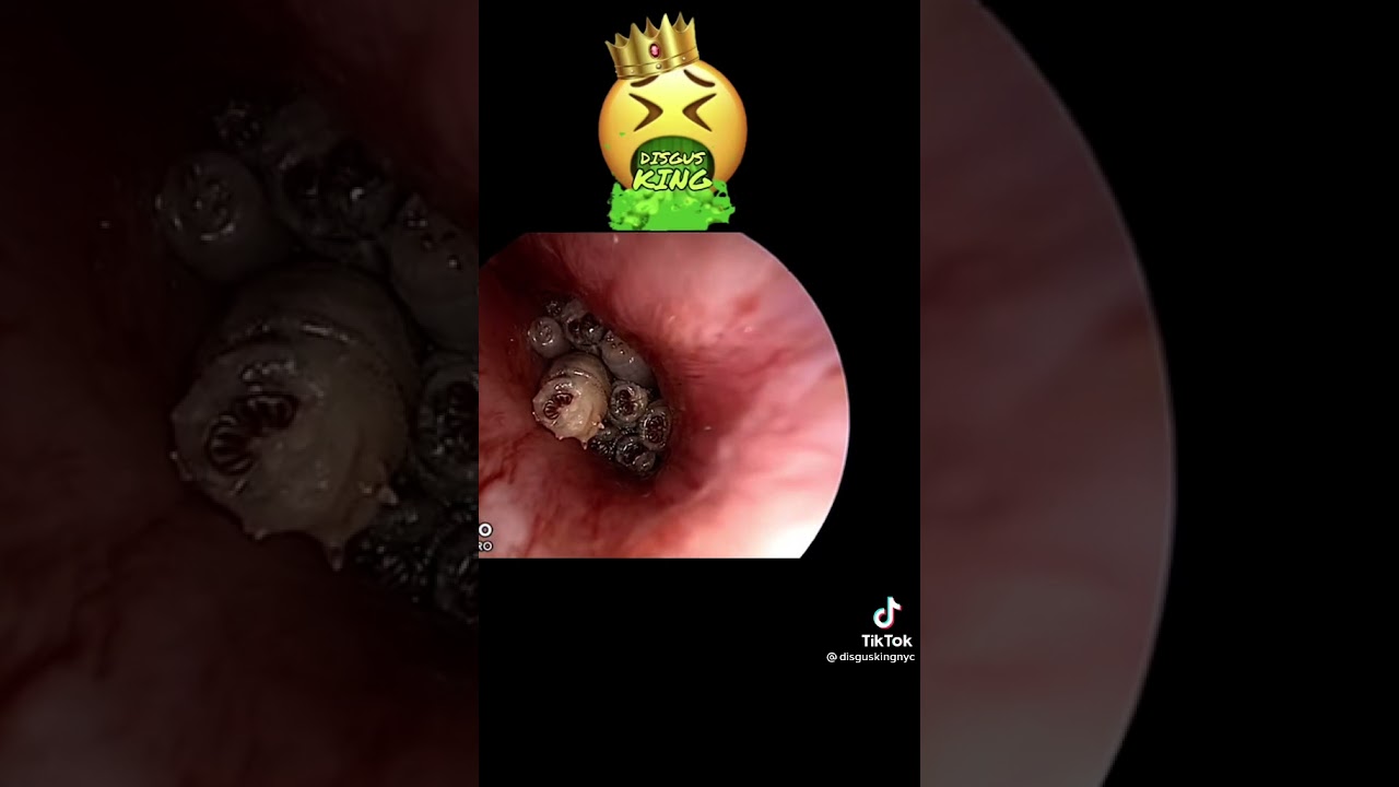 石橋静河 呪術廻戦 乃木坂46 長谷川百々花 地震 松岡茉優 膀胱がん フィギュア ヒロアカ 横浜流星 大坂なおみ