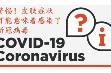 误诊漏诊 冠状病毒COVID-19患者中最常见的五个皮肤病变 细雨谈近期临床最常被误诊的新冠患者