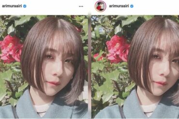 ニュース -  有村藍里、整形から２年半経過し心境「固執から解放されつつある。手術して２年半かけてやっと」