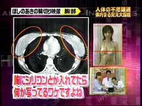 ほしのあきの輪切り映像