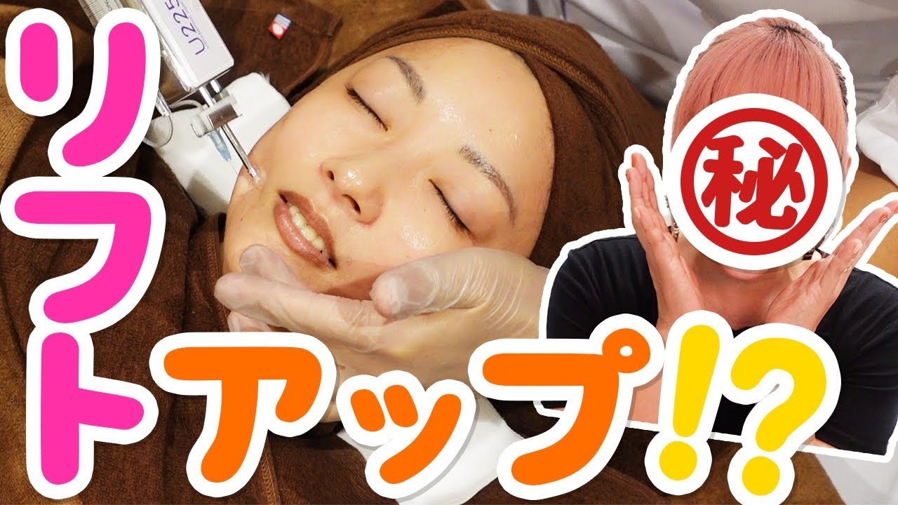 銀座アイグラッドクリニックでリフトアップ!お顔の変化が凄い!!