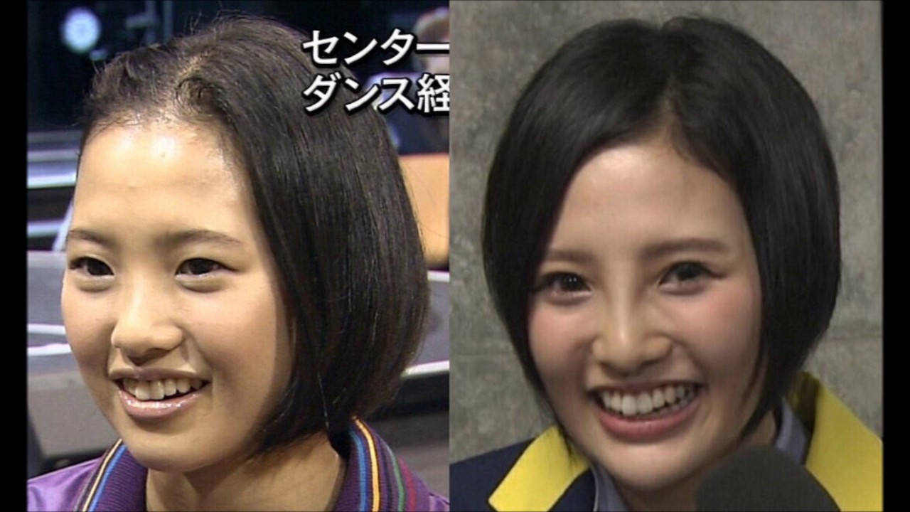 HKT48 兒玉遥 はるっぴ 整形。
