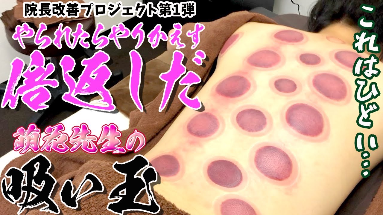 【吸い玉】吸い玉で過去最強最悪の結果が登場!慢性疲労や不調回復に最適な吸い玉で萌花先生が劇的改善させていきます【カッピング】