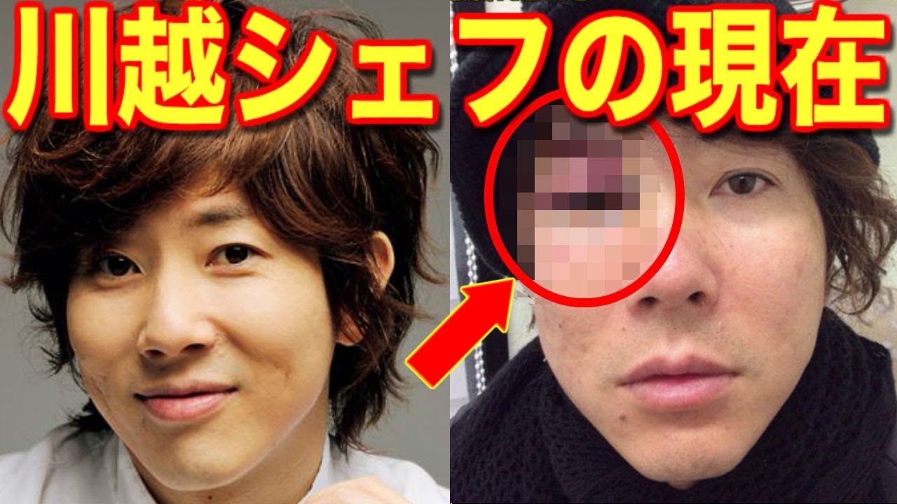 川越シェフの現在!姿を消した本当の理由が衝撃…”顔面崩壊事件”と”水騒動”の真相とは…【あの人は今】