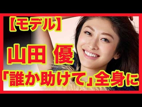 【モデル】山田優「誰か助けて」全身に原因不明のじんましん