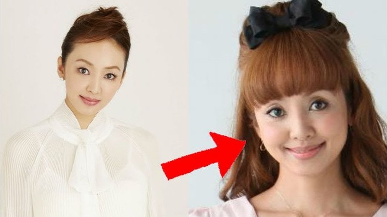 【エンタメ】神田うの「汚い顔は失礼」で炎上!ヒアルロン酸注射の代償【Buzzにゅ~】