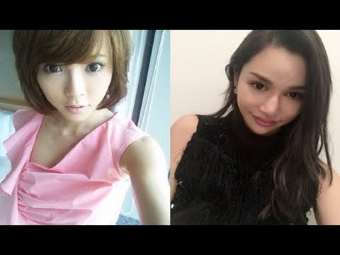 【閲覧注意】整形しすぎた芸能人 顔が変形しすぎ!もう限界?整形がばれる・・ここまで行くと「もはや別人」