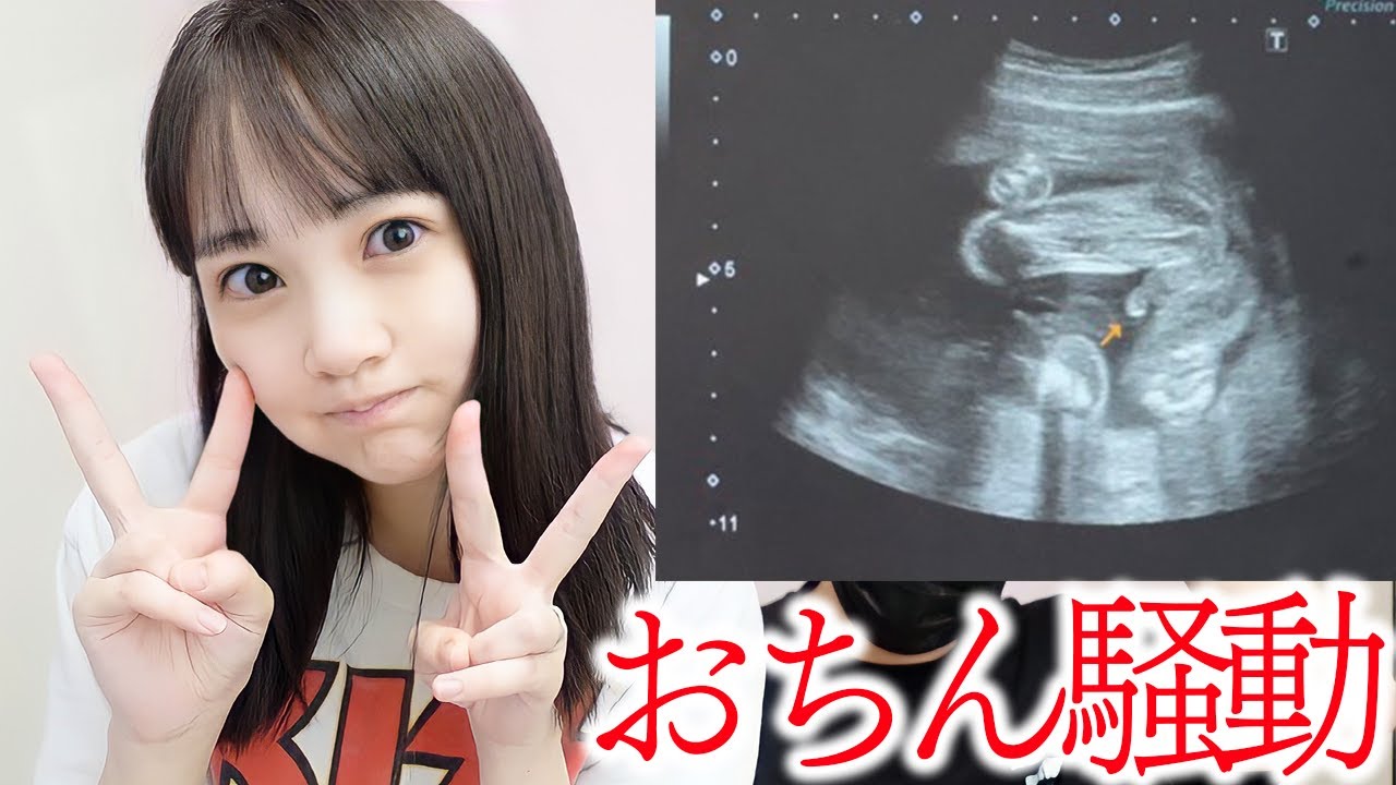 性別判明動画の「おちん」は勘違いでした【妊娠22週】