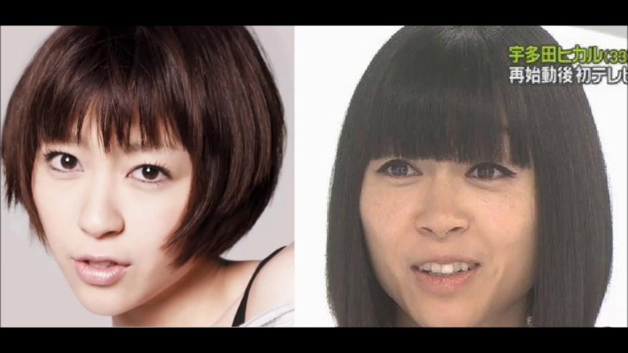 別人?顔面を変化させる芸能人たち。劣化・整形ビフォーアフター