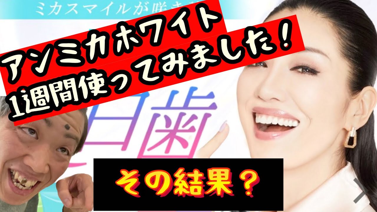 輝く歯を目指して話題のアンミカホワイト購入!その結果とは?