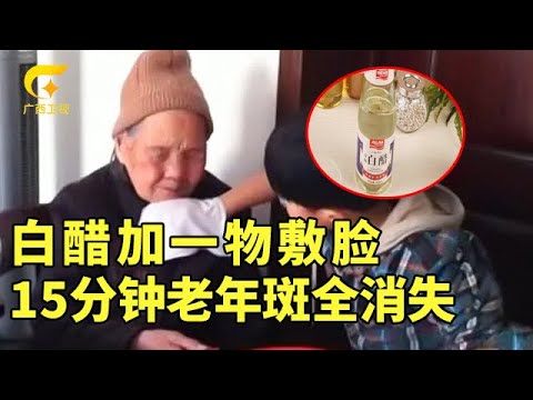 脸上密密麻麻全是斑点?白醋加一物,敷脸15分钟,老年斑像灰尘一样,洗一把脸全都不见了,皮肤光滑像剥壳鸡蛋【百科新说】