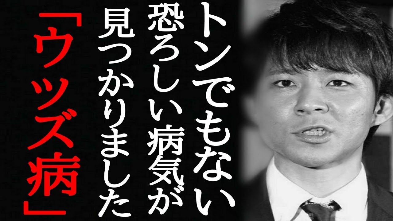 渡部建はS〇X依存症⁉佐々木希と不倫相手だけじゃ物足りない、自身がが語った「僕はウッツ病」の内容と裏事情に一同騒然