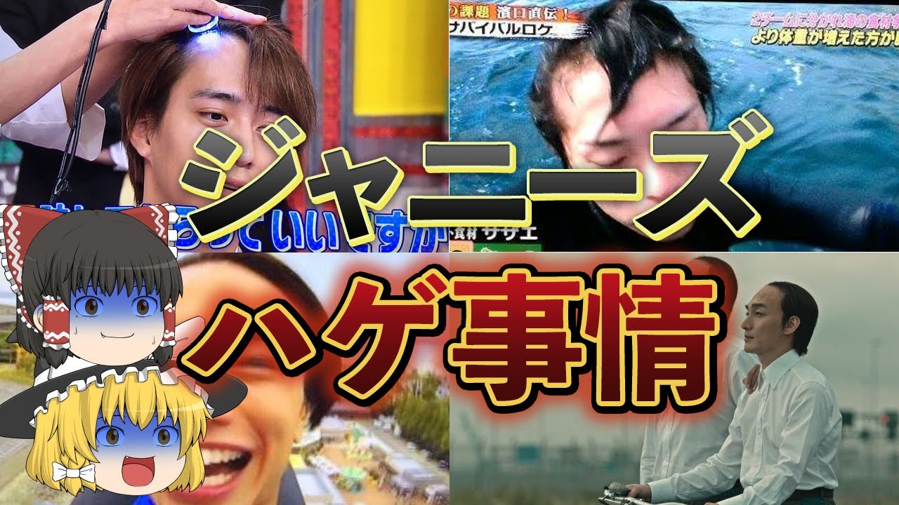 【ゆっくり解説】ジャニーズメンバーの悲惨すぎるハゲ・薄毛事情まとめ