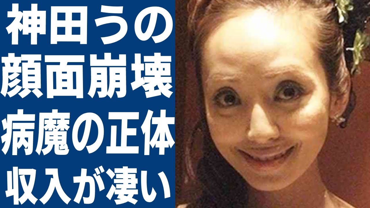 神田うのの整形で顔面崩壊したと言われやる現在の姿に言葉を失う…セレブなイメージが強い女性タレントの難病の正体や旦那の資産額に度肝を抜かれた!