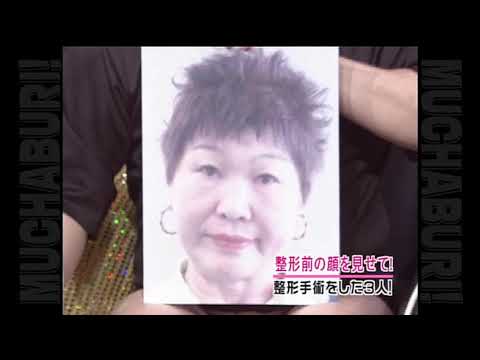 むちゃぶり!第5回「整形手術をした3人」