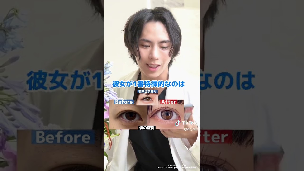 橋本環奈さんの二重の点数は?