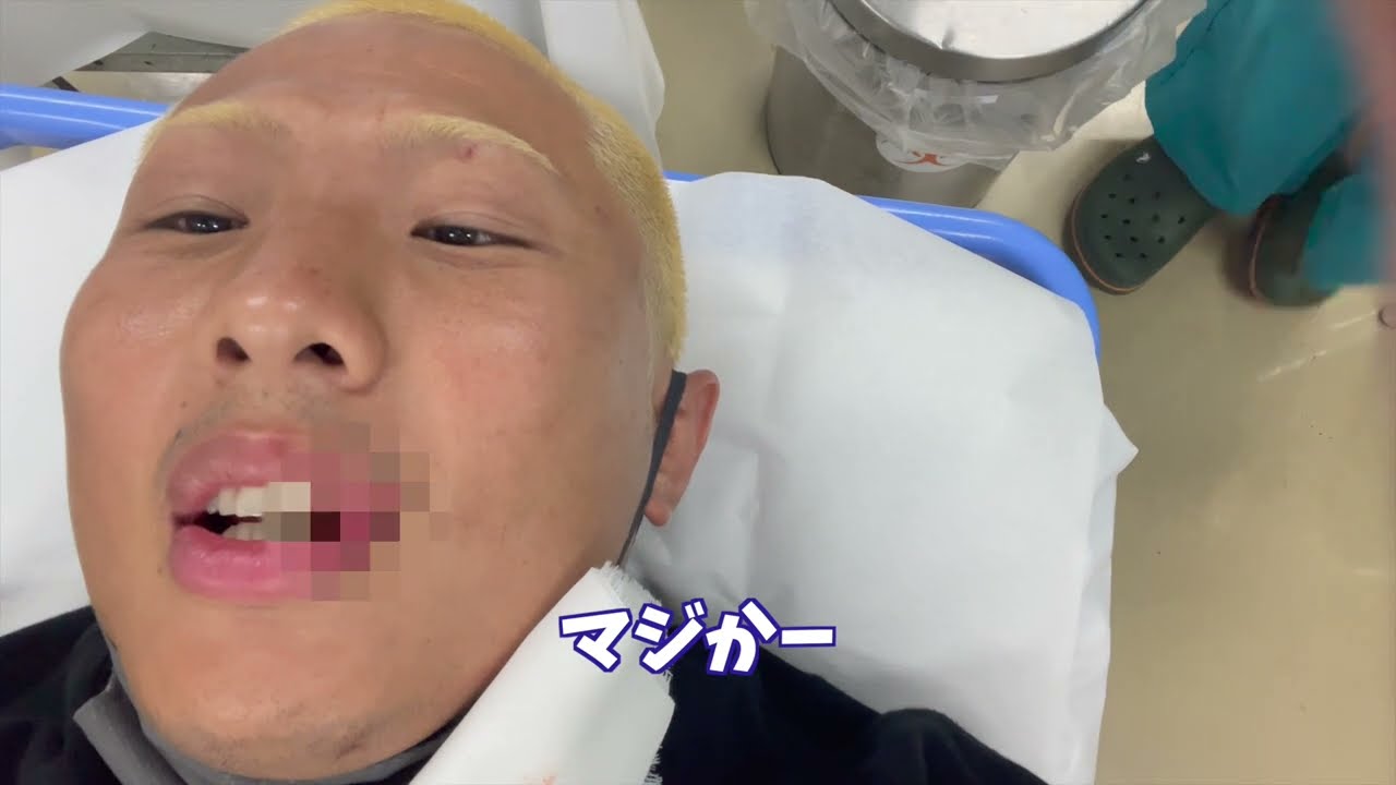 【オーディションの裏側】史上最悪の大怪我をした森許さん