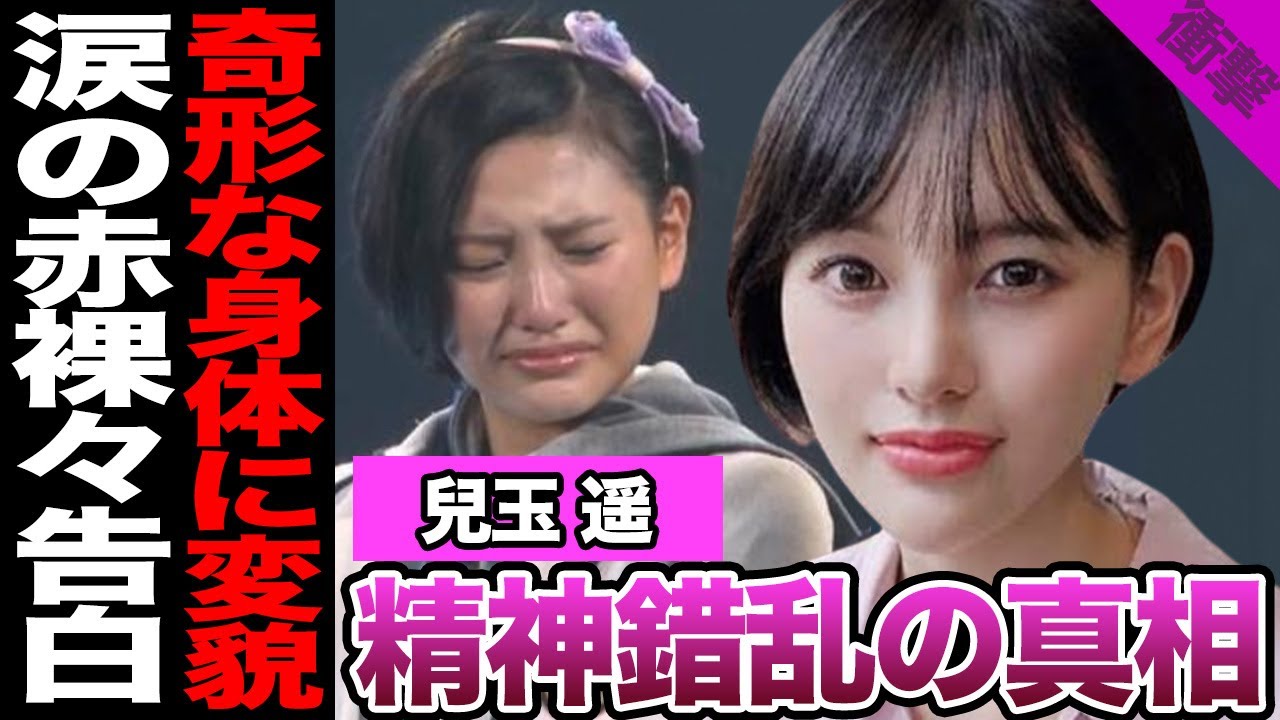 兒玉遥が壮絶な現状を涙ながらに告白…過食嘔吐の常習状態、コンプレックスが爆発で1,000万円規模の顔面課金、制御できない精神錯乱状態に絶句【芸能・アイドル・HKT48】