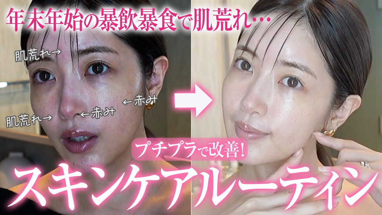 【暴飲暴食】年末年始の肌荒れを改善!33歳・2児の母のプチプラ&時短スキンケアルーティン【敏感肌|乾燥肌|酒さ】