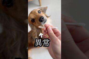 耳垢が異常だったから病院行ったらまさかの事実だった！