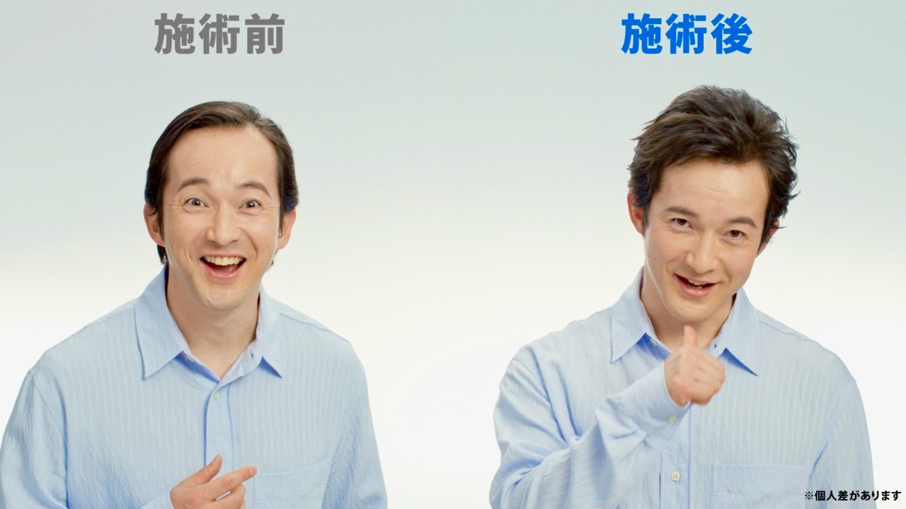 浅利陽介37歳、増毛ビフォーアフターに感激!引っ張って感動!渡部篤郎がプレゼンター/アートネイチャーCM+インタビュー+メイキング