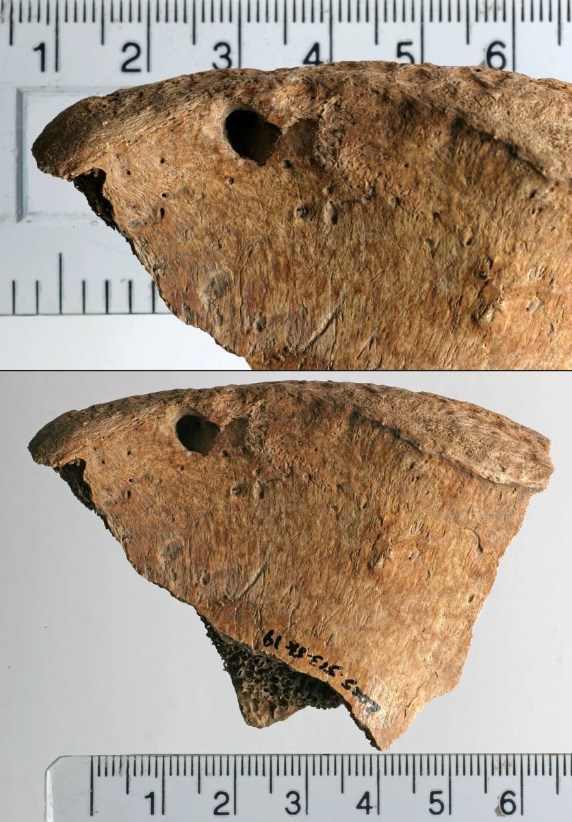 肉食動物が残した傷には治癒した兆候が見られない。男性はこの傷がもとで死亡したと考えられる/PLOS One