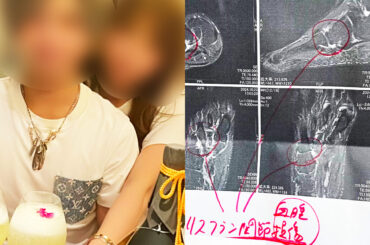 ホストクラブで“色恋営業”にハマってしまったと打ち明ける被害女性のAさん（写真はAさん提供）