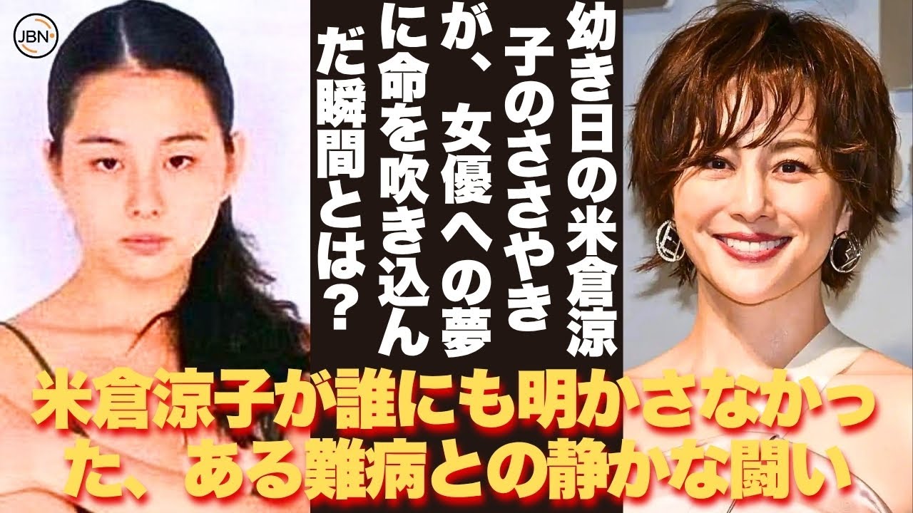 【懐かしい】ウソでしょ…同じ人なの!?米倉涼子さんのお顔に変化? 鼻や目元に注目集まる中、過去と現在を振り返る – 芸能人 昔と今 【米倉涼子】#懐かしい #芸能人
