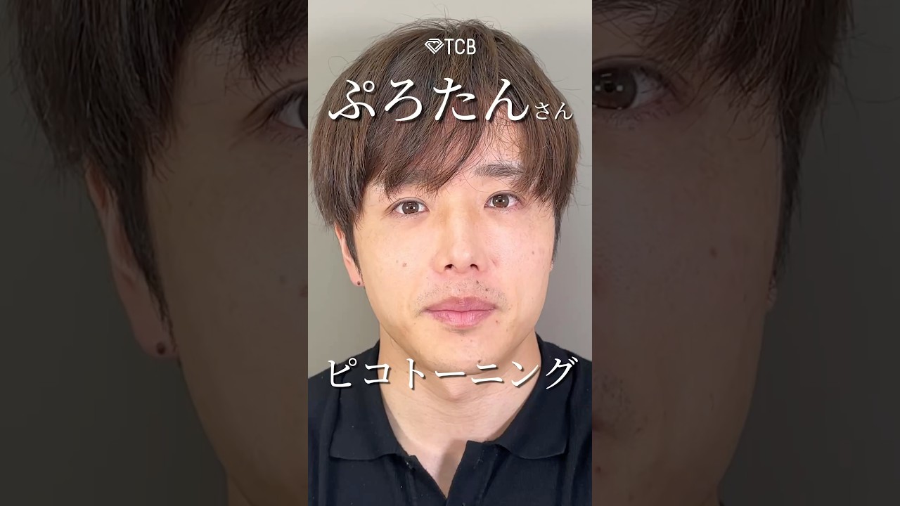 【美容整形】ぷろたんさんのピコトーニング #shorts