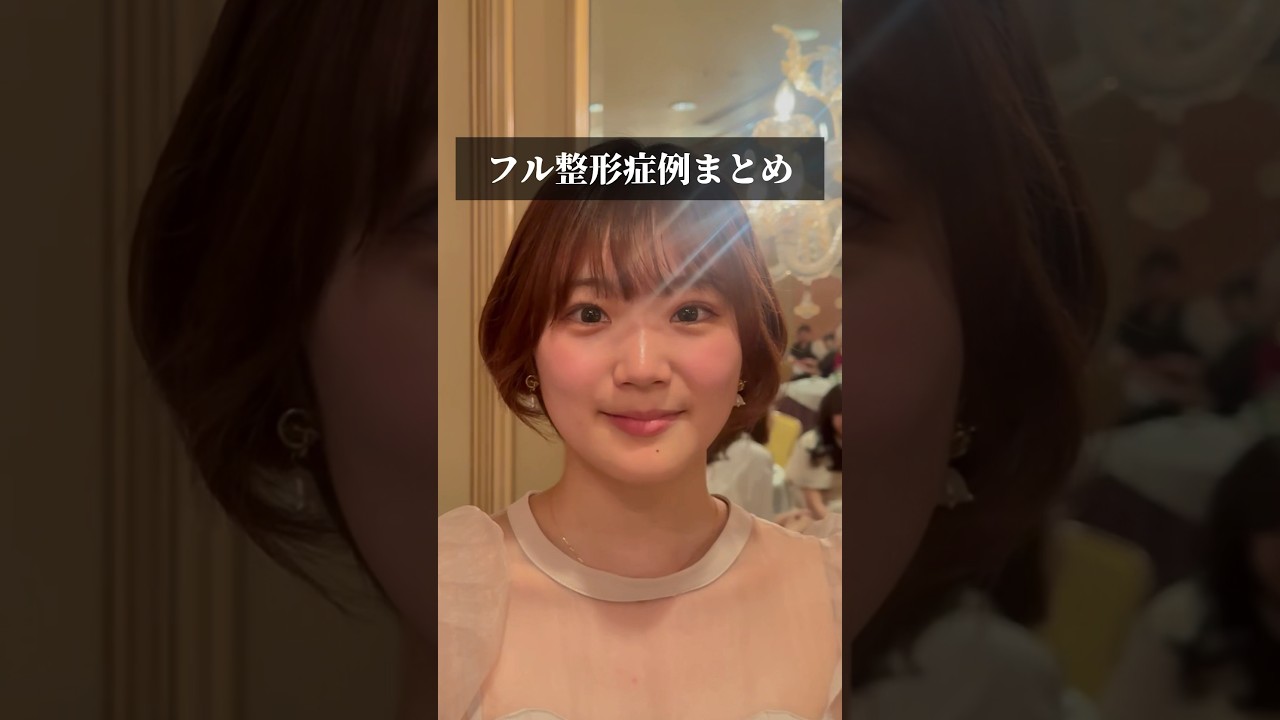 フル整形症例一挙公開! #shorts #整形 #ギャル #垢抜け #淡色女子 #垢抜け #ワンホン