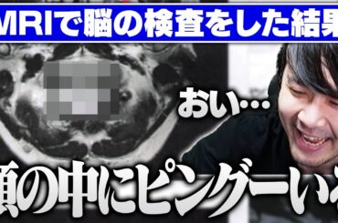 MRI検査で頭の中にピングーを飼っていることがバレるk4sen【雑談/Deviation Game】