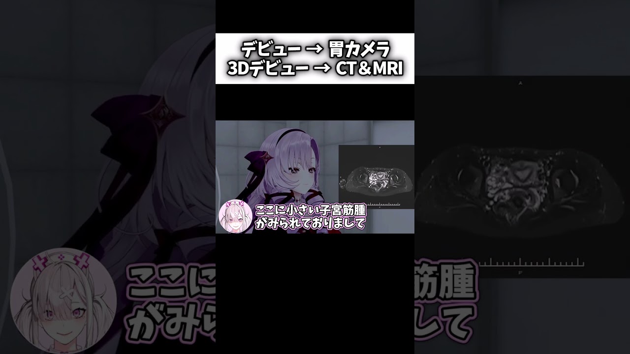 3Dデビューなので次の臓器を晒しますわ~!【にじさんじ切り抜き】 #壱百満天原サロメ #shorts