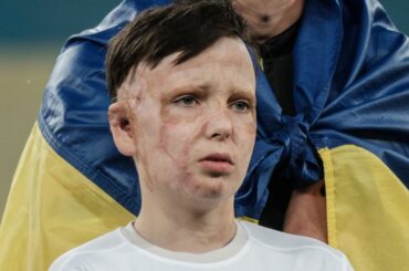 通訳が涙で訳せなかった「母との最後」。ロシアの攻撃で母を失い、36回手術を受けたウクライナの子どもの訴え | ハフポスト WORLD