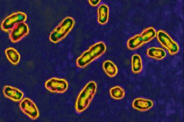 中世の黒死病の大流行、火山の噴火が引き金か　新研究 - CNN.co.jp