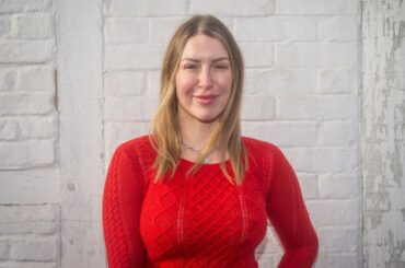 2022年に植毛手術を受けたトレーシー・キスさん